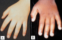 Figure 5 . A & B.