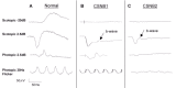 Figure 1. . Representative full-field ERGs recorded from three males: A.