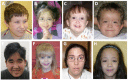 Figure 1. . Eight individuals with deletions in the 15q24 region.